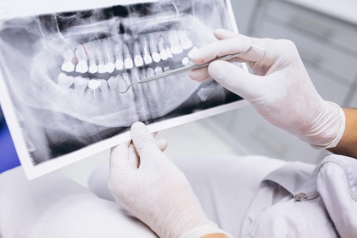 urgencia dentista málaga
